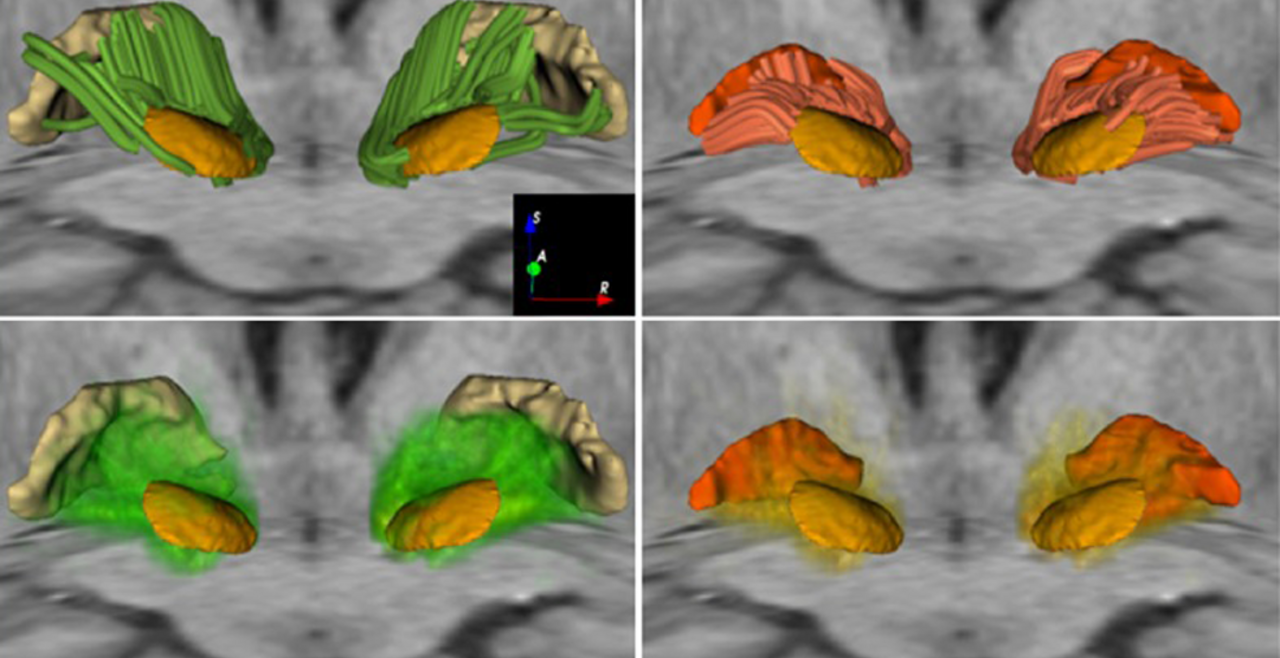 In vivo Exploration of the Connectivity between the Subthalamic Nucleus 
